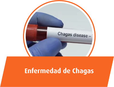 Enfermedad de Chagas
