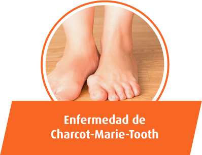 Enfermedad de Charcot-Marie-Tooth