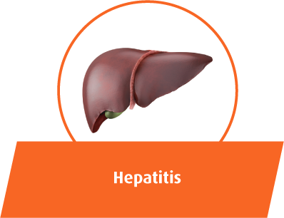 Hepatitis