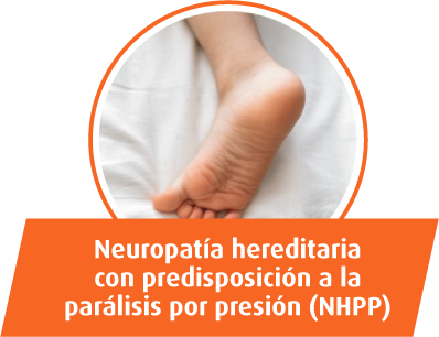 Neuropatía hereditaria