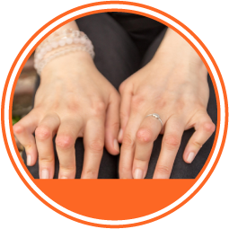 Neuropatía motora multifocal círculo