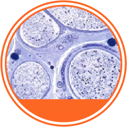 Síndrome de Guillain-Barré círculo