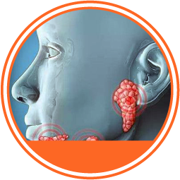 Síndrome de Sjögren círculo