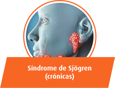 Síndrome de Sjögren