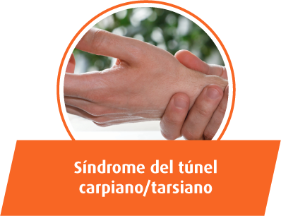 Síndrome del túnel carpiano