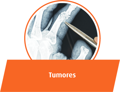 Tumores