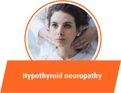 Hypothyroid neuropathy