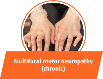 Multifocal motor neuropathy
